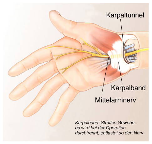 Karpaltunnel anatomisch